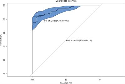 Predictive Modeling of MAFLD Based on Hsp90α and the Therapeutic Application of Teprenone in a Diet-Induced Mouse Model